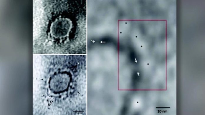 Transmission electron microscopy imaging of Covid-19 | Photo from Indian Journal of Medical Research