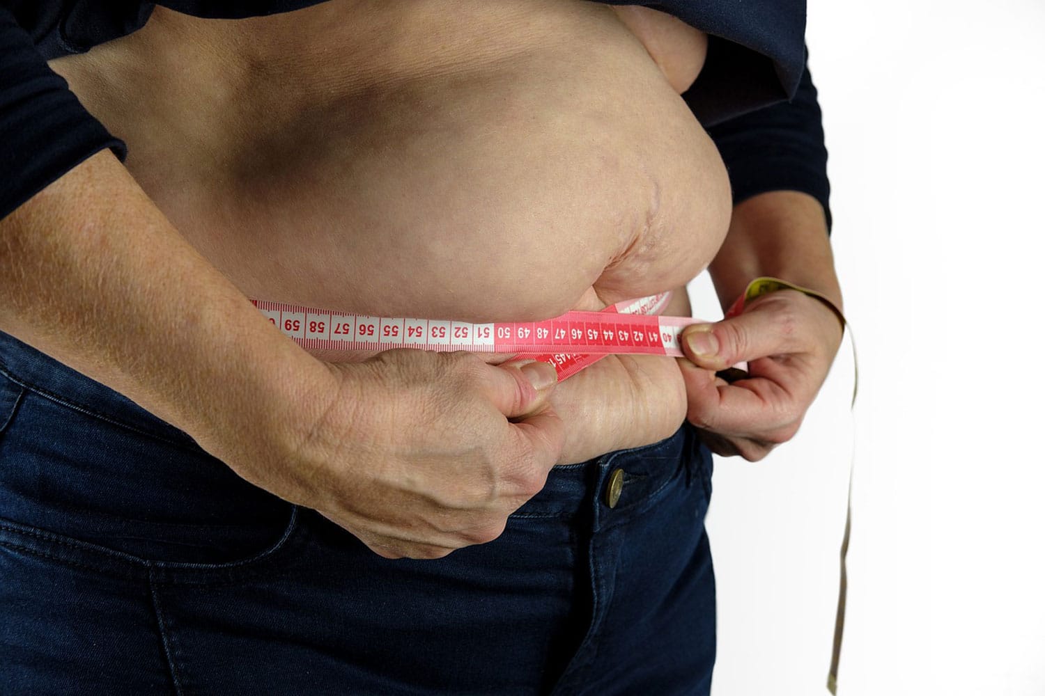 Being overweight may cause more hospital admissions than previously thought thumbnail