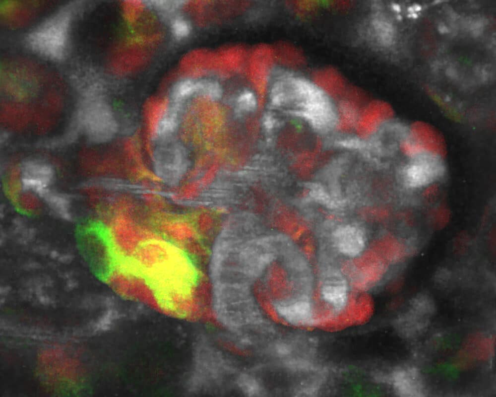 Image showing The kidney contains macula densa cells (green/yellow), which orchestrate kidney regeneration. The circulating plasma is labeled white/gray, and all kidney cells are labeled by their production of genetically inserted green and red fluorescent proteins.