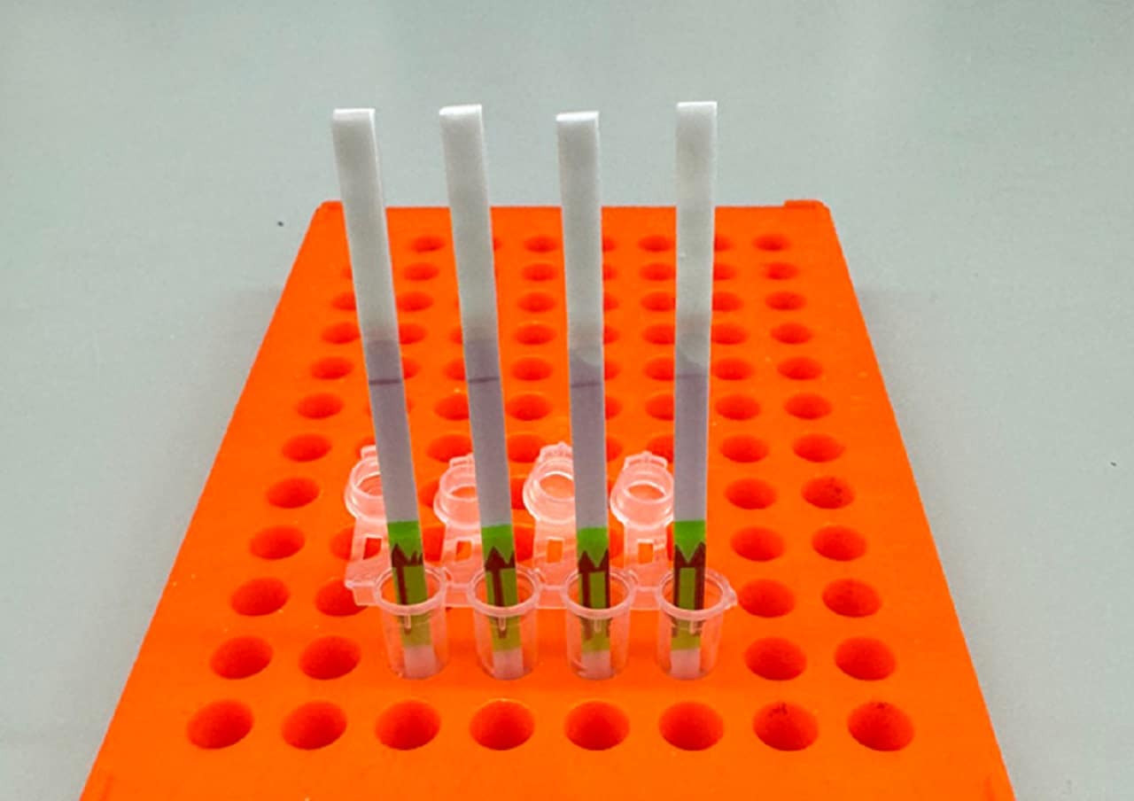 Image showing SHINE, a rapid diagnostic test developed by Pardis Sabeti's lab in 2020, uses paper strips and CRISPR enzymes to identify specific sequences of viral RNA in samples.