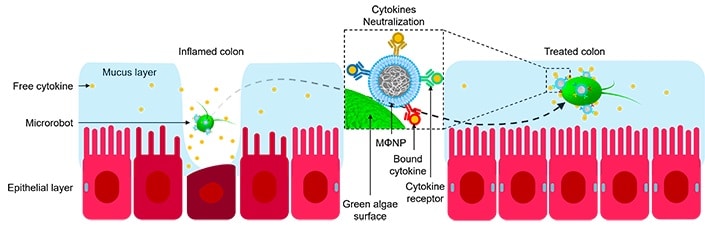 Image showing Illustration of a microrobot neutralizing pro-inflammatory cytokines to treat an inflamed colon in IBD.