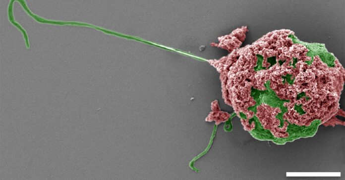 Image showing Colored SEM image of a microrobot made of an algae cell (green) covered with macrophage-mimicking nanoparticles (red). Scale bar: 5 µm.