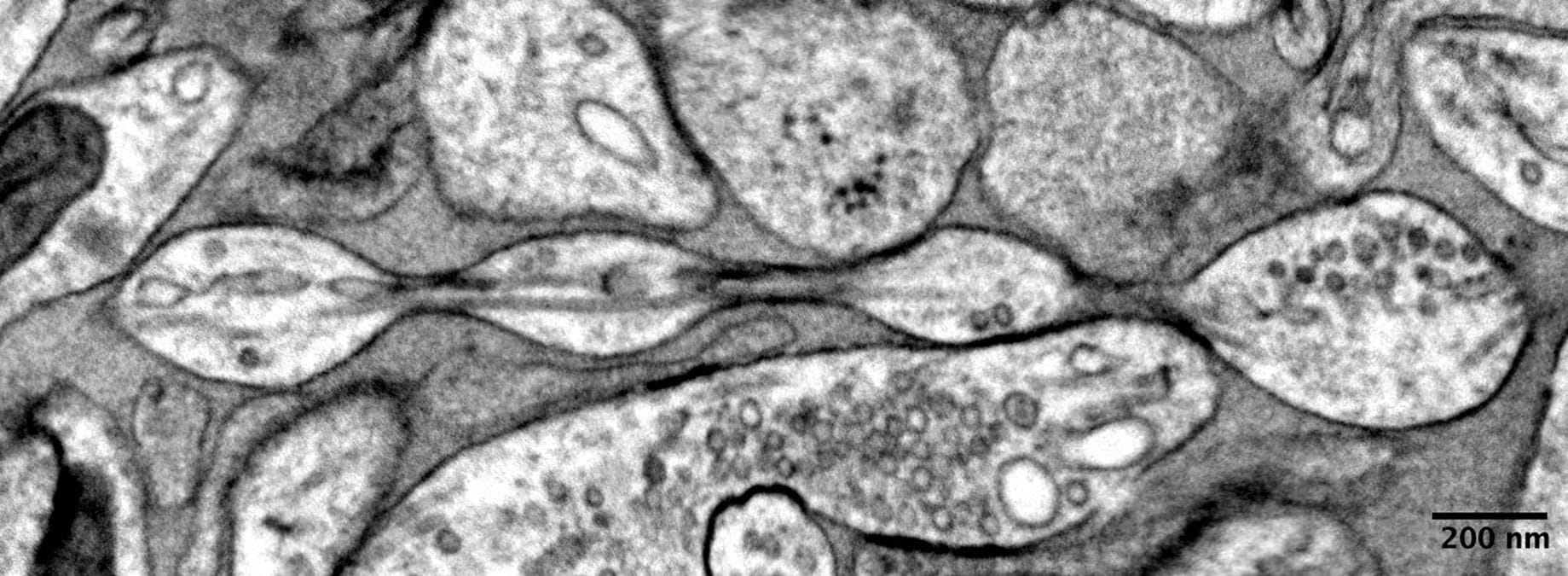 Study may reverse century-old understanding of axon shape thumbnail