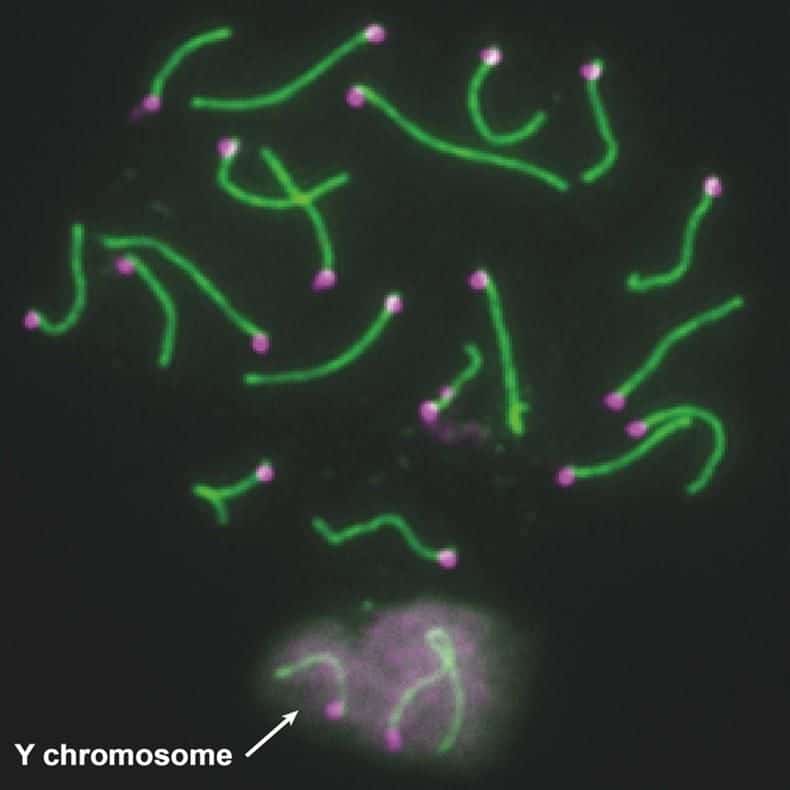 Y Chromosome Genes Found Crucial for Sperm Development and Male Fertility