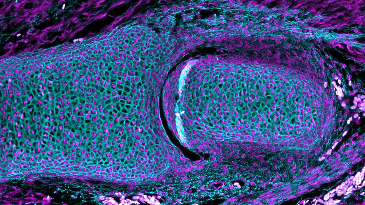 Immunostaining depicts collagen-2 (cyan) and nucleus (magenta) at the articulation in the little skate embryo's pelvic joint.